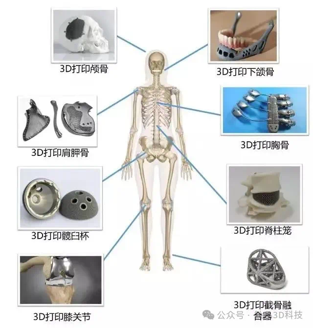 生物細胞的3D列印產品